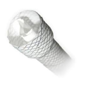 ST1007 – Esophageal Stent with Anti-reflux Valve