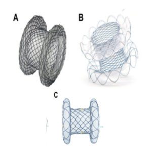 ST1005 – LAMS Stent