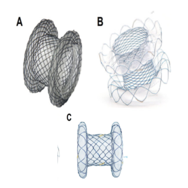 ST1005 - LAMS Stent