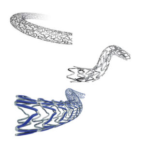 CORONARY STENT SYSTEM