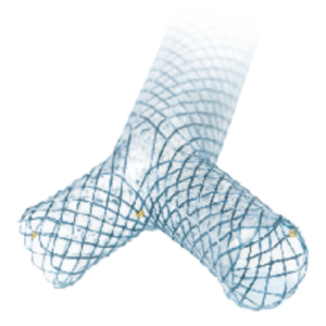 ST1010 – Y-STENT